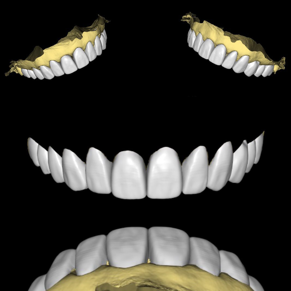 Digital Printing Digital Printing